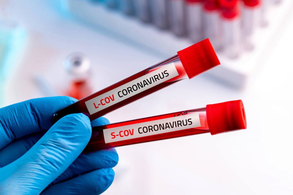 Coronavirus, covid