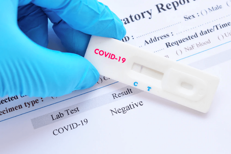 Covid, a breve test gratuito in farmacia per i genitori degli scolari