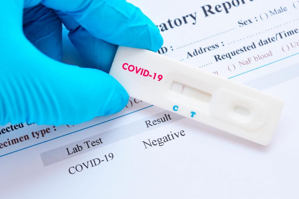coronavirus covid tampone