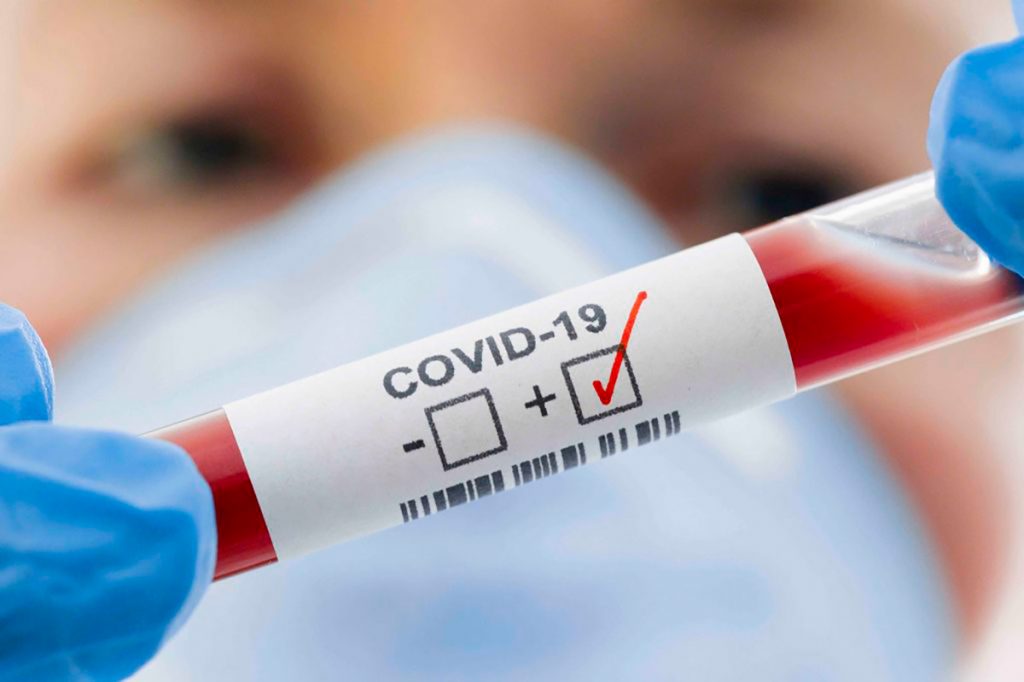 covid, coronavirus