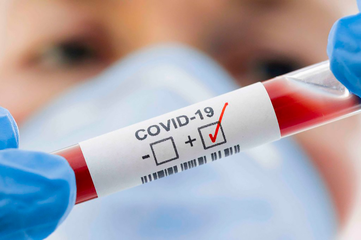 Coronavirus, contagi record