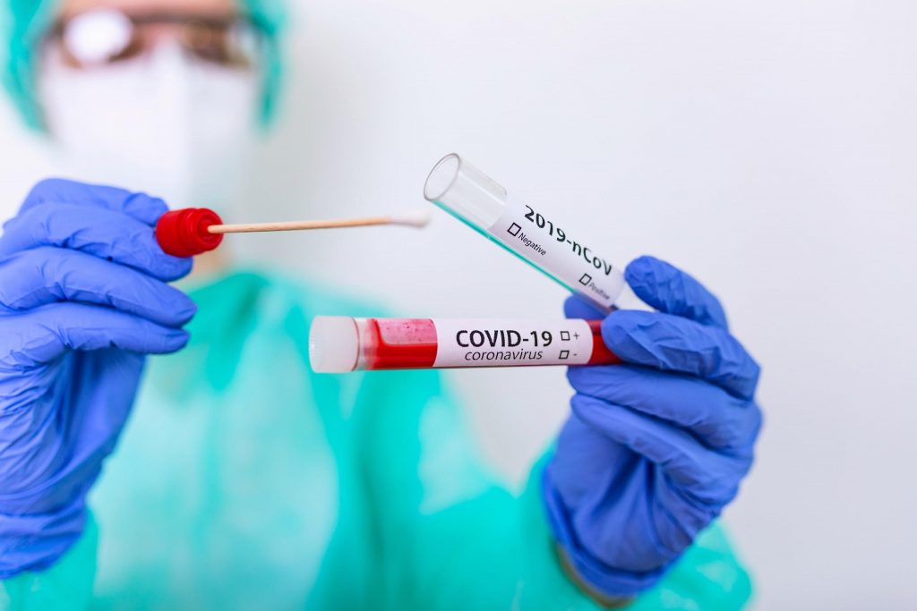 covid, coronavirus tampone