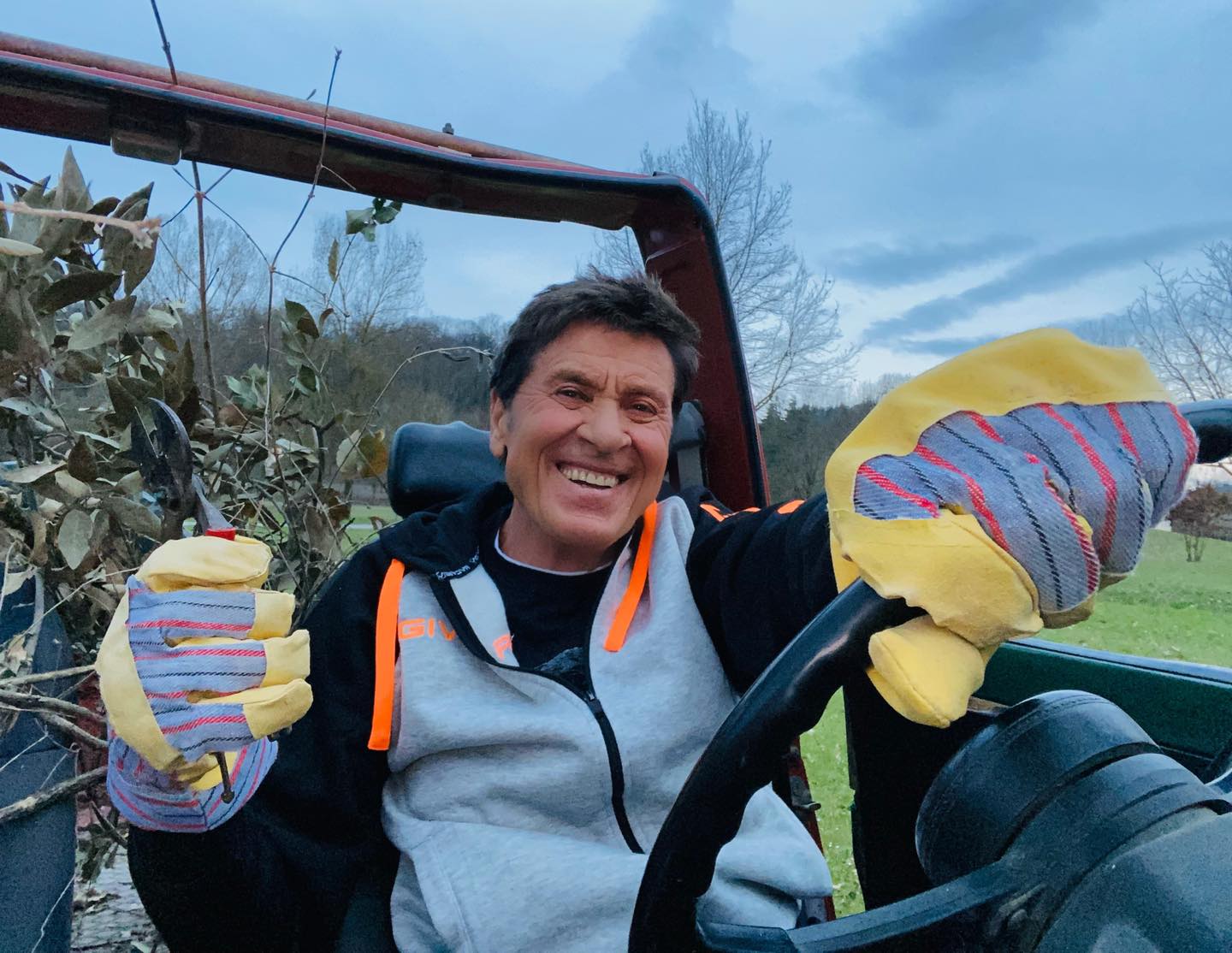 “Ustioni profonde a mani e gambe” per Gianni Morandi