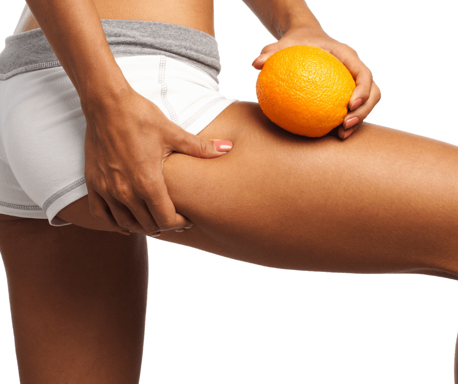 cellulite, pelle a buccia d'arancia come contrastarla